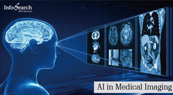 AI in medical imaging